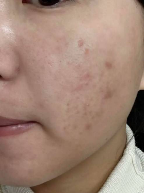 氨基酸洗面奶有那些?温和保湿的洗面奶