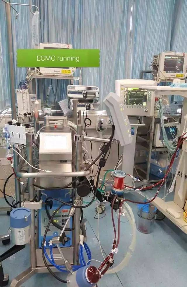 Exmo(ex模拟器d3d补丁)